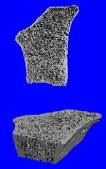 3D pQCT image of osteoporotic bone. (Image: Scanco Medical AG)