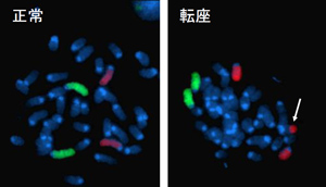 画像：図2　マウスES細胞の染色体異常
