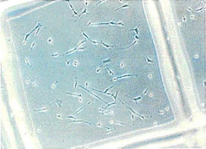 実験で使用した骨芽細胞（MC3C3-E1)