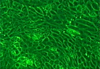 微小重力環境で培養した腎臓細胞（ｸA輅AXA/ 東京大学）